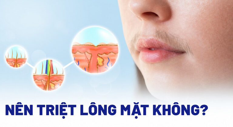 Có nên triệt lông mặt không? Lợi ích và lưu ý
