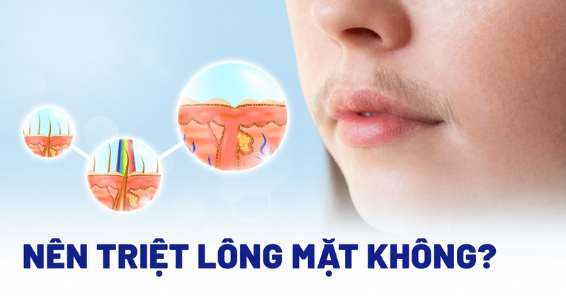 Triệt lông mặt cần được cân nhắc theo loại da, tình trạng lông và mức độ an toàn của phương pháp. 