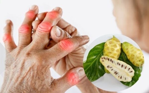 Trái nhàu trị bệnh gì? Công dụng, cách dùng và lưu ý an toàn