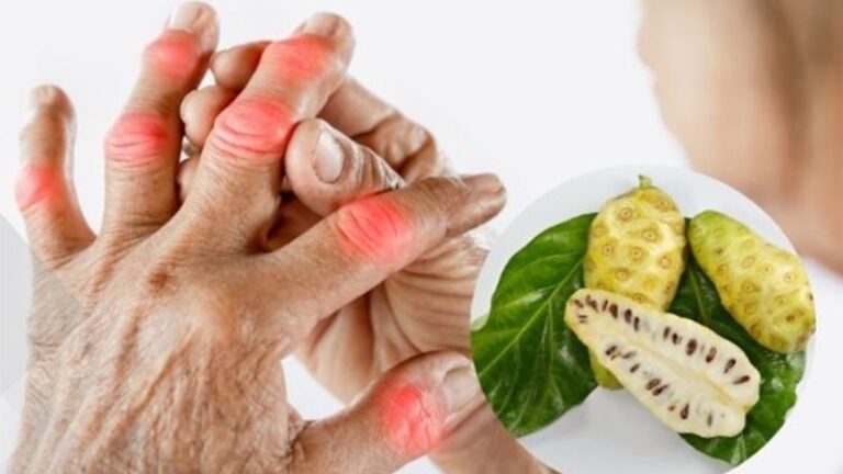 Trái nhàu trị bệnh gì? Công dụng, cách dùng và lưu ý an toàn
