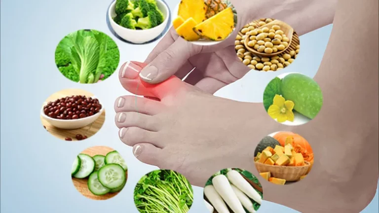 Bị gout kiêng ăn gì? Top thực phẩm cần hạn chế để kiểm soát axit uric